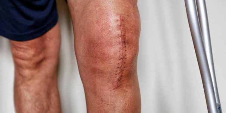 best hospital for knee replacement