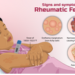 Everything you need to know about the rheumatic fever of childhood