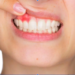 What Causes an Infection After a Root Canal?